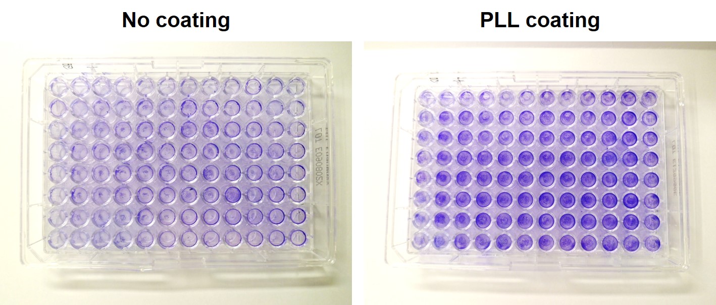 HEK Zellen mit und ohne PLL coating auf Greiner Plastik