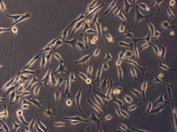 HeLa Zellen auf inhomogenem Plastik